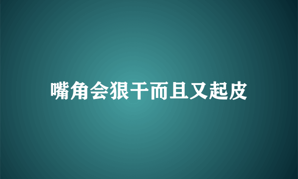 嘴角会狠干而且又起皮