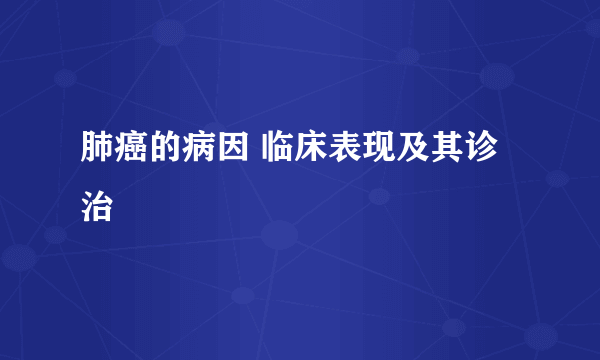 肺癌的病因 临床表现及其诊治