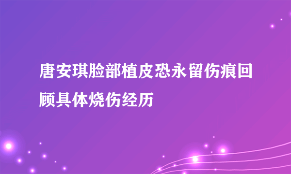 唐安琪脸部植皮恐永留伤痕回顾具体烧伤经历