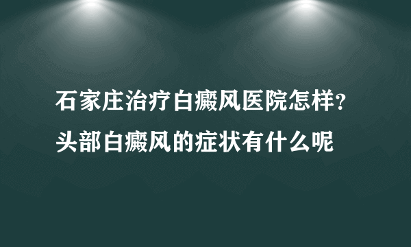 石家庄治疗白癜风医院怎样？头部白癜风的症状有什么呢