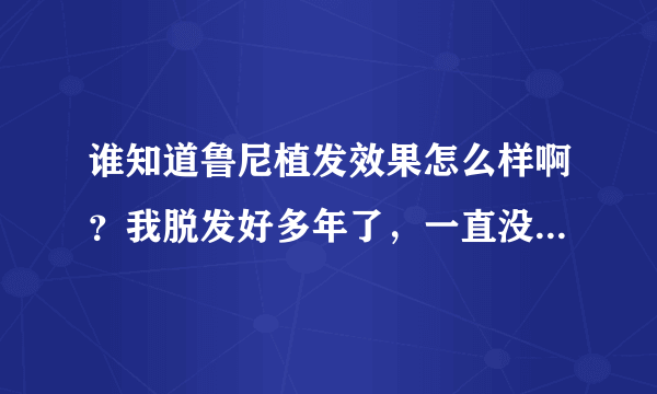 谁知道鲁尼植发效果怎么样啊？我脱发好多年了，一直没...