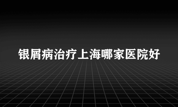 银屑病治疗上海哪家医院好