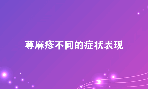 荨麻疹不同的症状表现