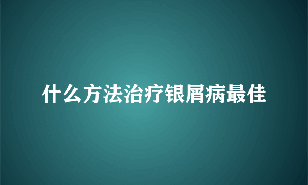 什么方法治疗银屑病最佳