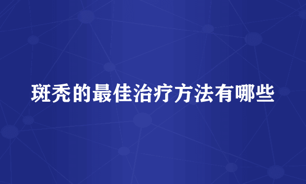 斑秃的最佳治疗方法有哪些