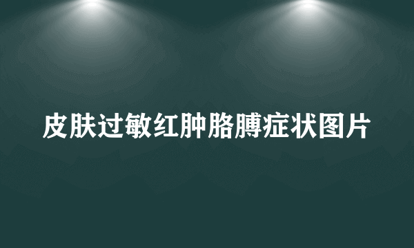 皮肤过敏红肿胳膊症状图片