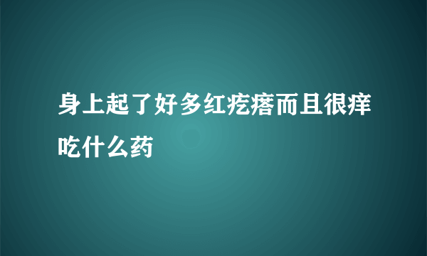 身上起了好多红疙瘩而且很痒吃什么药