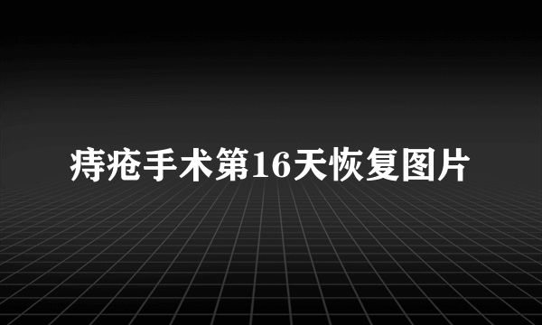 痔疮手术第16天恢复图片