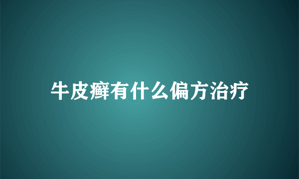 牛皮癣有什么偏方治疗