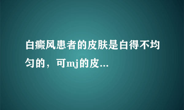 白癜风患者的皮肤是白得不均匀的，可mj的皮...