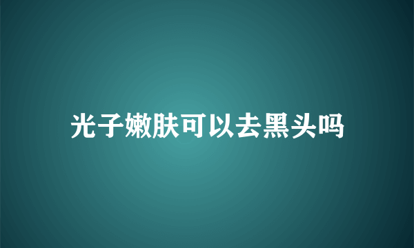 光子嫩肤可以去黑头吗