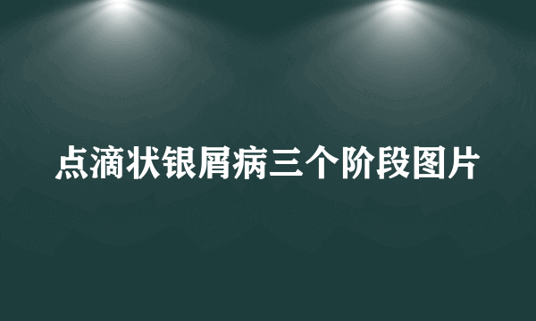 点滴状银屑病三个阶段图片