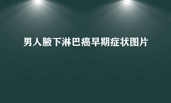 男人腋下淋巴癌早期症状图片