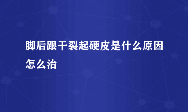 脚后跟干裂起硬皮是什么原因怎么治