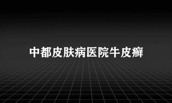 中都皮肤病医院牛皮癣