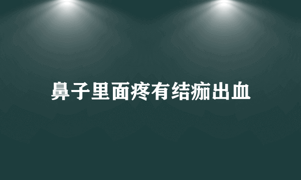 鼻子里面疼有结痂出血