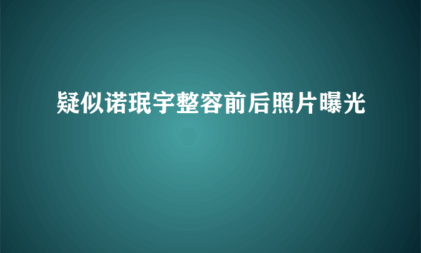 疑似诺珉宇整容前后照片曝光