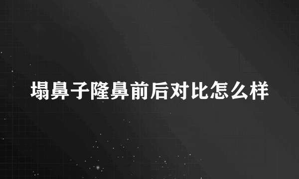 塌鼻子隆鼻前后对比怎么样