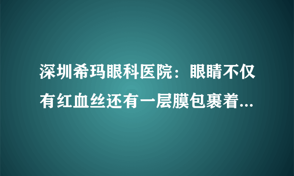 深圳希玛眼科医院：眼睛不仅有红血丝还有一层膜包裹着，到底是怎么回