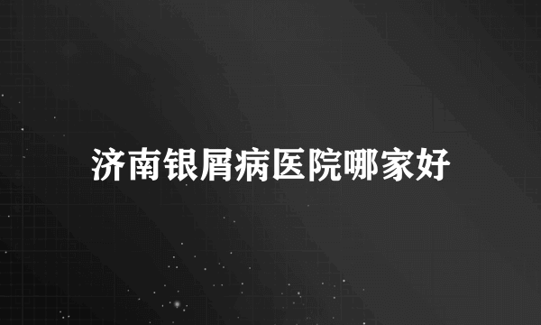 济南银屑病医院哪家好