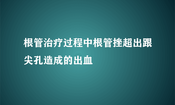 根管治疗过程中根管挫超出跟尖孔造成的出血