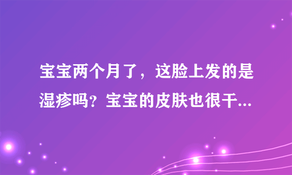 宝宝两个月了，这脸上发的是湿疹吗？宝宝的皮肤也很干还有脱皮了，怎么办？急死了