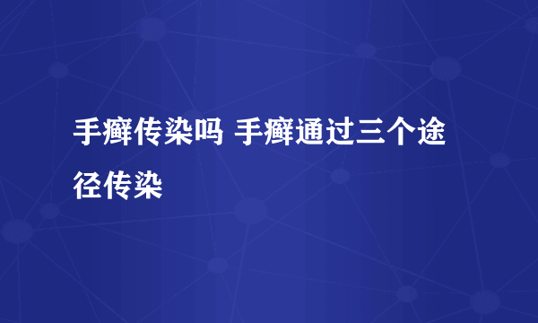 手癣传染吗 手癣通过三个途径传染