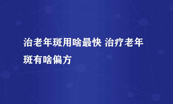 治老年斑用啥最快 治疗老年斑有啥偏方