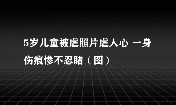 5岁儿童被虐照片虐人心 一身伤痕惨不忍睹（图）