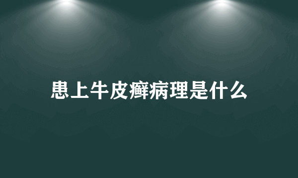 患上牛皮癣病理是什么